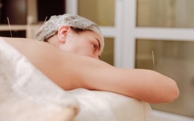 10 Ways Acupuncture Helps Maintain a Healthy Lifestyle